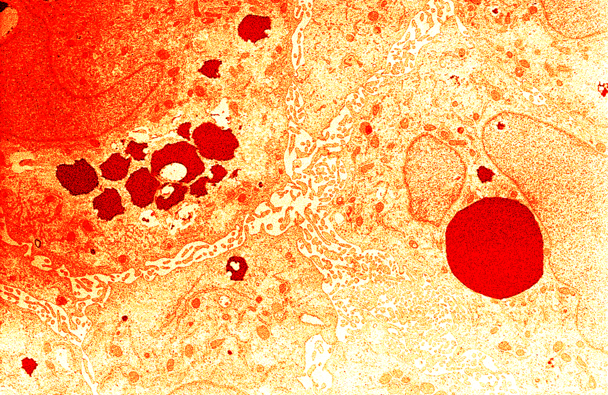 Liver Cells in Red